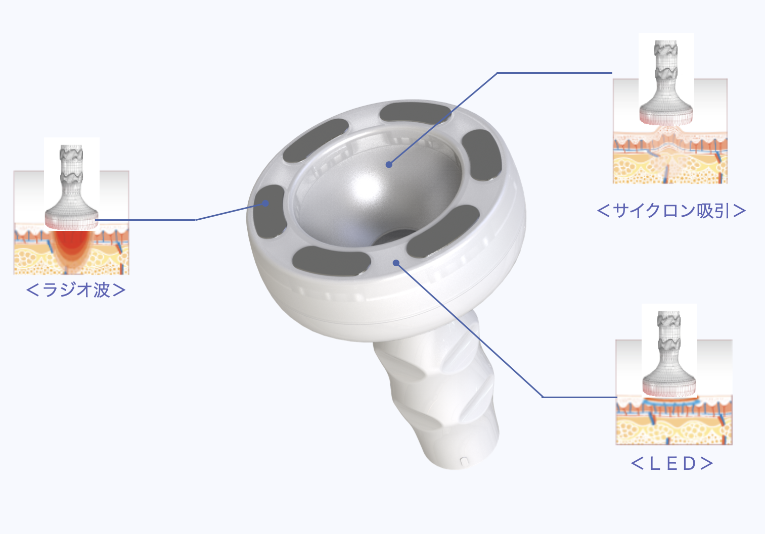 サイクロンラジ