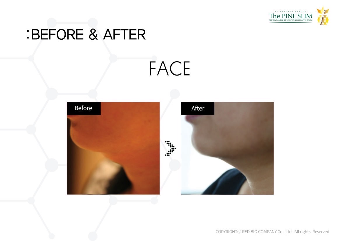 パインショット Before After フェイス3
